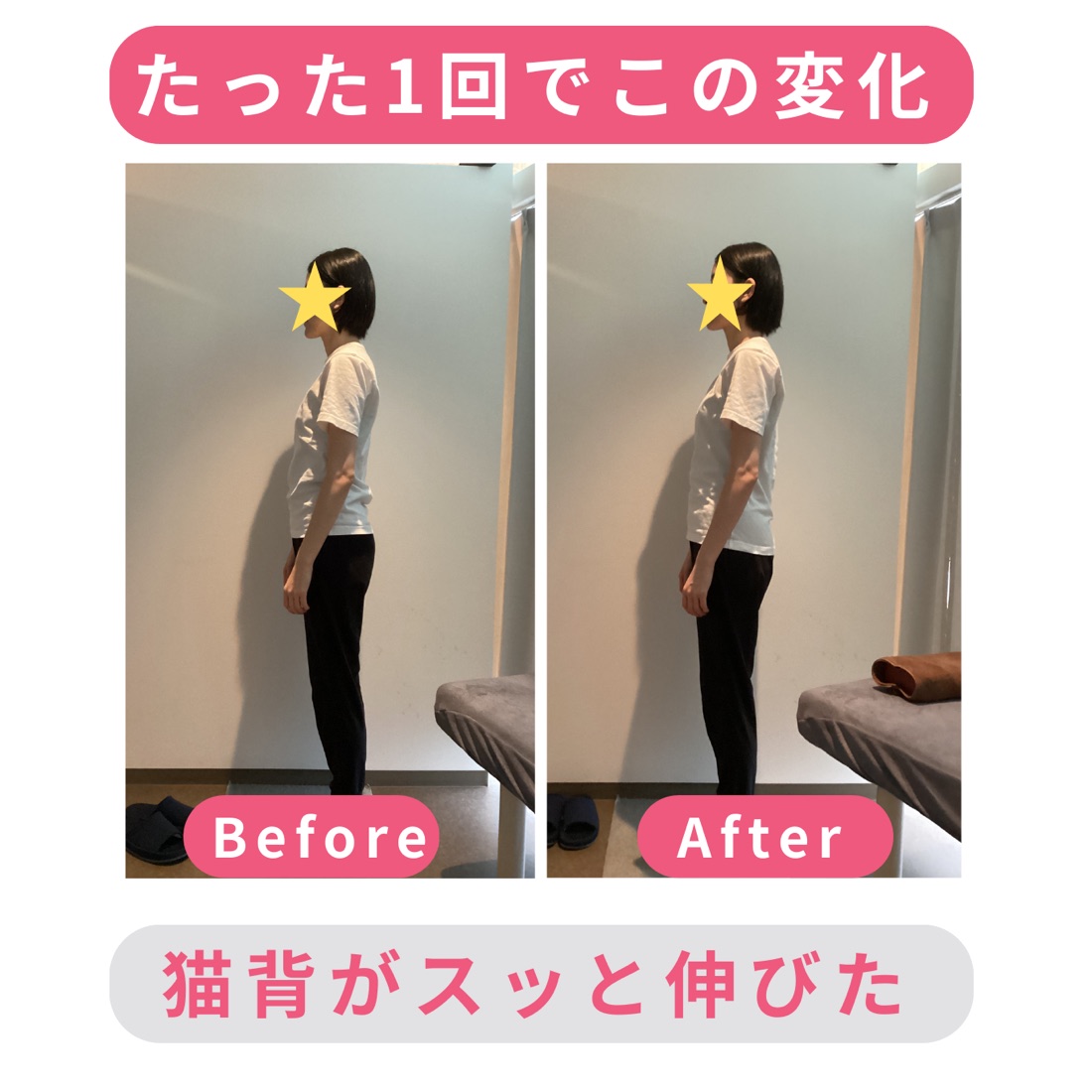 施術前後の姿勢の比較（左：施術前／右：施術後）